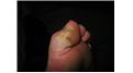 Most Steps Taken In A Month