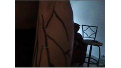 Most Staples Stapled In A Body