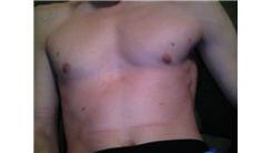 Most Nipples (Male)