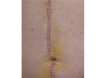 Most Staples In A Stomach