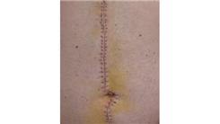 Most Staples In A Stomach