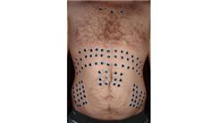 Most Googly Eyes Attached To A Body