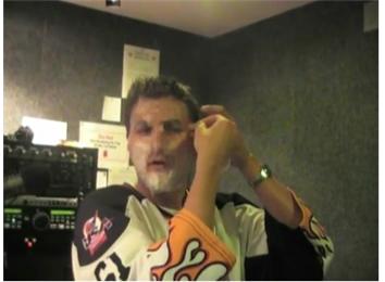 Most Pieces Of Tape Taped To Face At Once