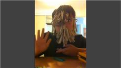 Most Pegs Attached To An 11-Year-Old Boy's Face