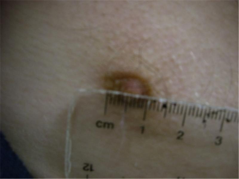 Smallest Nipple (Male)