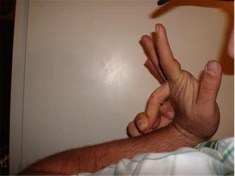 Most Fingers Bent Backwards To Touch One\'s Own Forearm